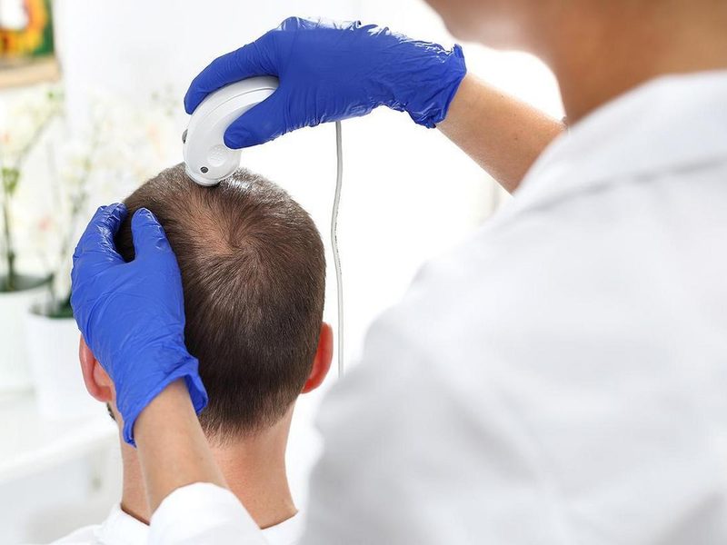 Hair and Skin Treatment at Expert Clinic Health